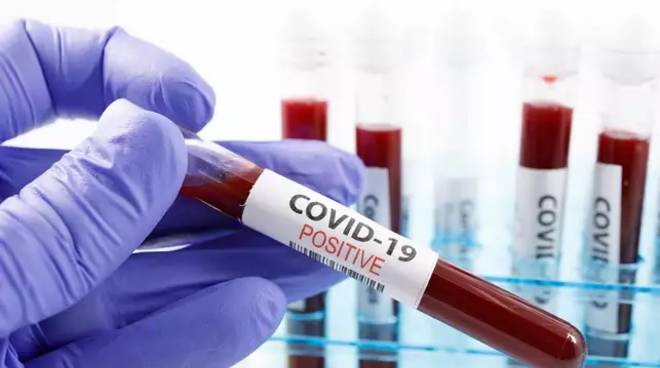 Test sierologici sui donatori di sangue, Avis denuncia: nessuna ulteriore azione in caso di positività